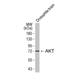 AKT antibody (GTX128415)